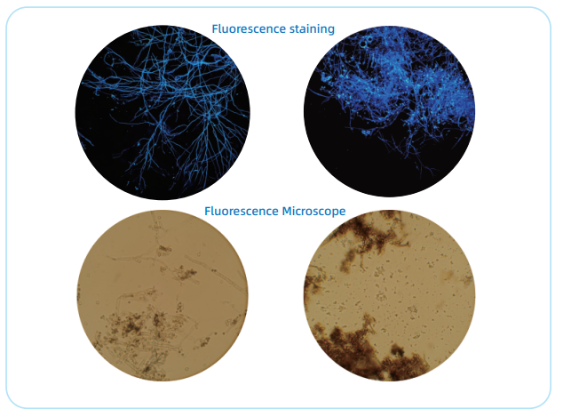 真菌及荧光染色液3.png